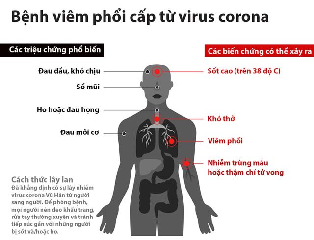 các dấu hiệu của bệnh viêm hô hấp cấp cho virus corona