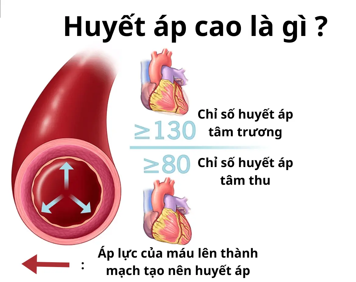 Nguyên nhân cốt lõi: Vì sao áp lực máu lại tăng?