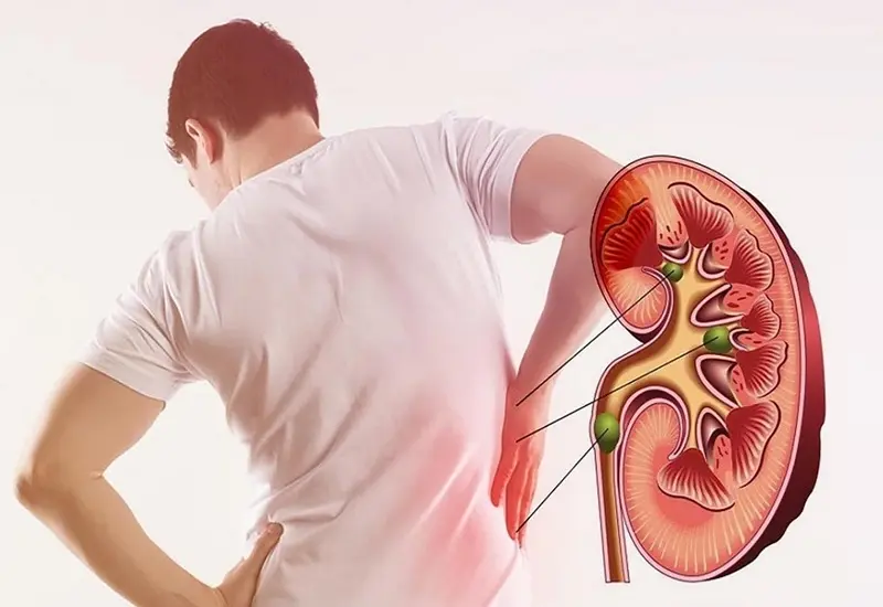 Biến chứng nguy hiểm nếu không kiểm soát